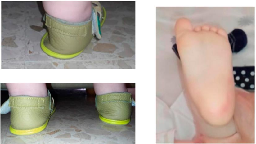 Importancia del calzado en los niños